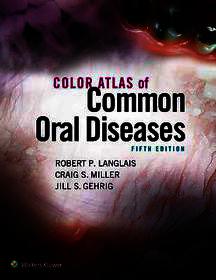 Color Atlas of Common Oral Diseases