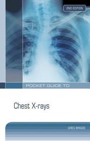 Pocket Guide to Chest X-Rays Pocket Guide to Chest X-Rays