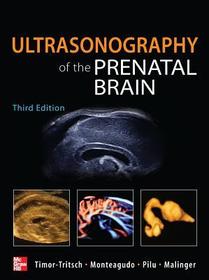 Ultrasonography of the Prenatal Brain, Third Edition Ultrasonography of the Prenatal Brain, Third Edition
