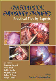 Gynecological Endoscopy Simplified: Practical Tips by Experts