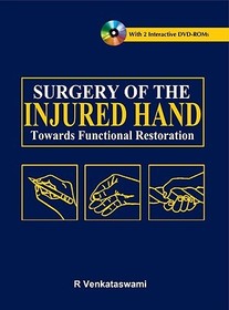 Surgery of the Injured Hand: Towards Functional Restoration