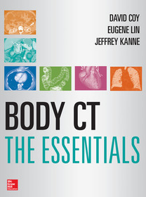 Body CT The Essentials: The Essentials