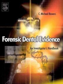 Forensic Dental Evidence: An Investigator's Handbook