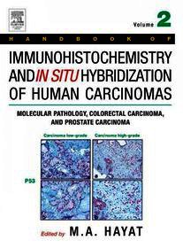 Handbook of Immunohistochemistry and in Situ Hybridization of Human Carcinomas: Molecular Pathology, Colorectal Carcinoma, and Prostate Carcinoma