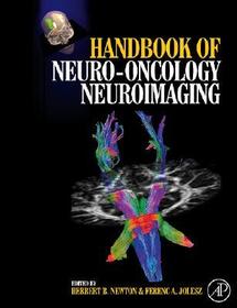 Handbook of Neuro-Oncology Neuroimaging