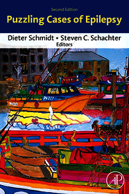 Puzzling Cases of Epilepsy