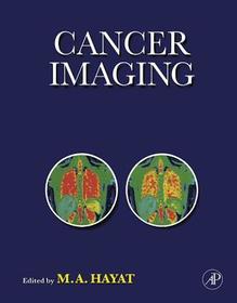 Cancer Imaging