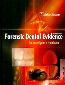 Forensic Dental Evidence: An Investigator's Handbook