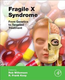 Fragile X Syndrome: From Genetics to Targeted Treatment