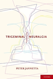 Trigeminal Neuralgia