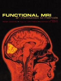 Functional Magnetic Resonance Imaging: An Introduction to Methods