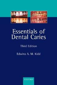 Essentials of Dental Caries: The disease and its management