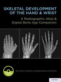 Skeletal Development of the Hand and Wrist: A Radiographic Atlas and Digital Bone Age Companion
