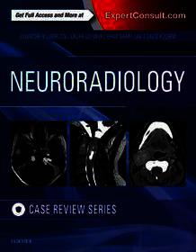 Neuroradiology Imaging Case Review