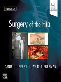 Surgery of the Hip: Expert Consult - Online and Print