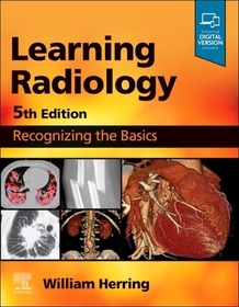Learning Radiology: Recognizing the Basics Learning Radiology: Recognizing the Basics