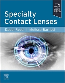 Specialty Contact Lenses Specialty Contact Lenses