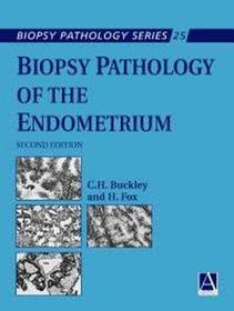 Biopsy Pathology of the Endometrium, 2Ed Biopsy Pathology of the Endometrium, 2Ed