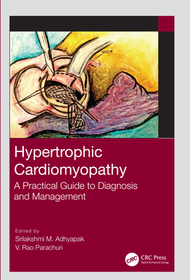 Hypertrophic Cardiomyopathy: A Practical Guide to Diagnosis and Management