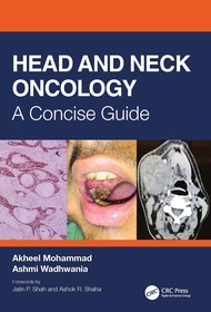Head and Neck Oncology: A Concise Guide Head and Neck Oncology: A Concise Guide