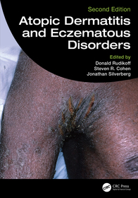 Atopic Dermatitis and Eczematous Disorders