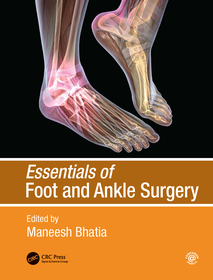 Essentials of Foot and Ankle Surgery