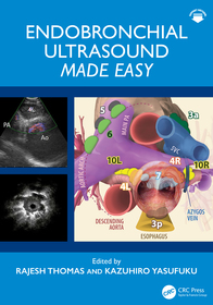 Endobronchial Ultrasound Made Easy: Made Easy Endobronchial Ultrasound Made Easy: Made Easy