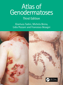 Atlas of Genodermatoses Atlas of Genodermatoses