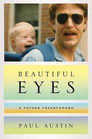 Beautiful Eyes ? A Father Transformed: A Father Transformed