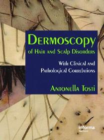 Dermoscopy of Hair and Scalp Disorders: With Clinical and Pathological Correlations