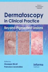 Dermatoscopy in Clinical Practice: Beyond Pigmented Lesions