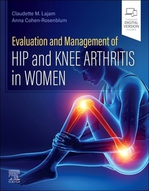 Evaluation and Management of Hip and Knee Arthritis in Women Evaluation and Management of Hip and Knee Arthritis in Women