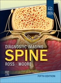 Diagnostic Imaging: Spine Diagnostic Imaging: Spine