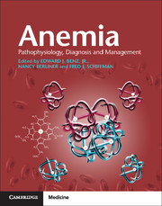 Anemia Paperback with Online Resource: Pathophysiology, Diagnosis, and Management