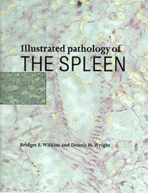 Illustrated Pathology of the Spleen