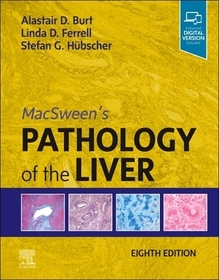 MacSween's Pathology of the Liver MacSween's Pathology of the Liver