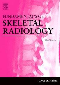 Fundamentals of Skeletal Radiology
