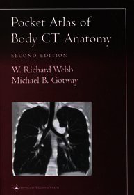 Pocket Atlas of Body CT Anatomy
