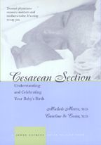 Cesarean Section: Understanding and Celebrating Your Baby's Birth