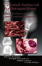 Crystal-Induced Arthropathies: Gout, Pseudogout and Apatite-Associated Syndromes