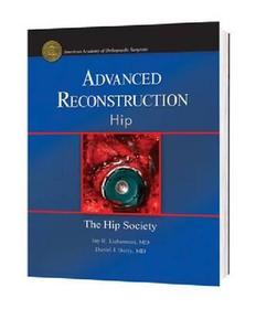 Advanced Reconstruction: Hip