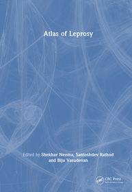 Atlas of Leprosy Atlas of Leprosy