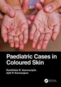 Paediatric Cases in Coloured Skin Paediatric Cases in Coloured Skin