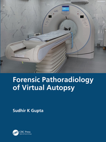 Forensic Pathoradiology of Virtual Autopsy Forensic Pathoradiology of Virtual Autopsy