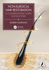 Non-Surgical Hair Restoration: A Comprehensive Guide for Doctors