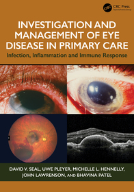 Investigation & Management of Eye Disease in Primary Care: Infection, Inflammation and Immune Response