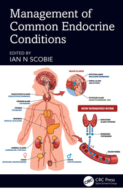 Management of Common Endocrine Conditions