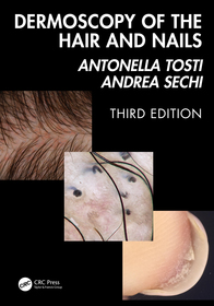 Dermoscopy of the Hair and Nails 3e Dermoscopy of the Hair and Nails 3e