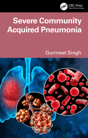 Severe Community-Acquired Pneumonia