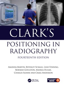 Clark's Positioning in Radiography